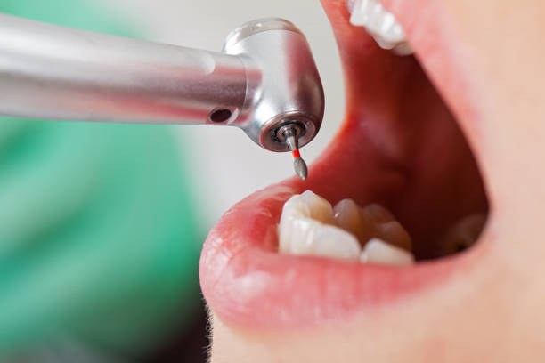 Best Pediatric Emergency Dentist in Emerald Bay, TX